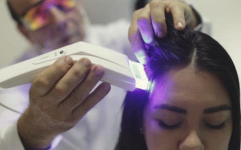 calvície - laser e eletroestimulação