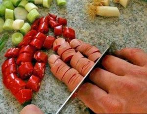 Pessoas que não sentem dor: 5 fatos sobre